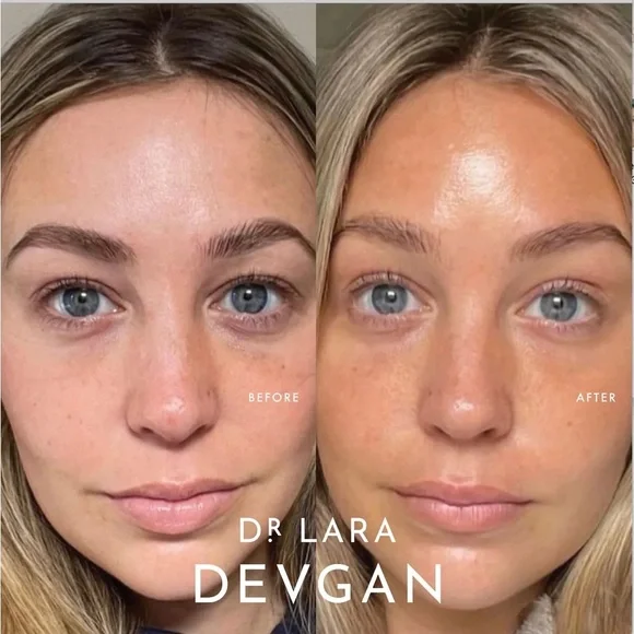 DR. LARA DEVGAN- Peptide Eye Cream - Picture 9 of 13